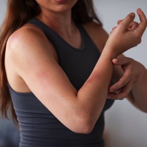 Antiseptics, and Skin care products